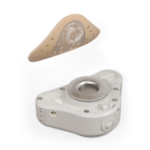 Bone Anchored Hearing Aids (BAHA)